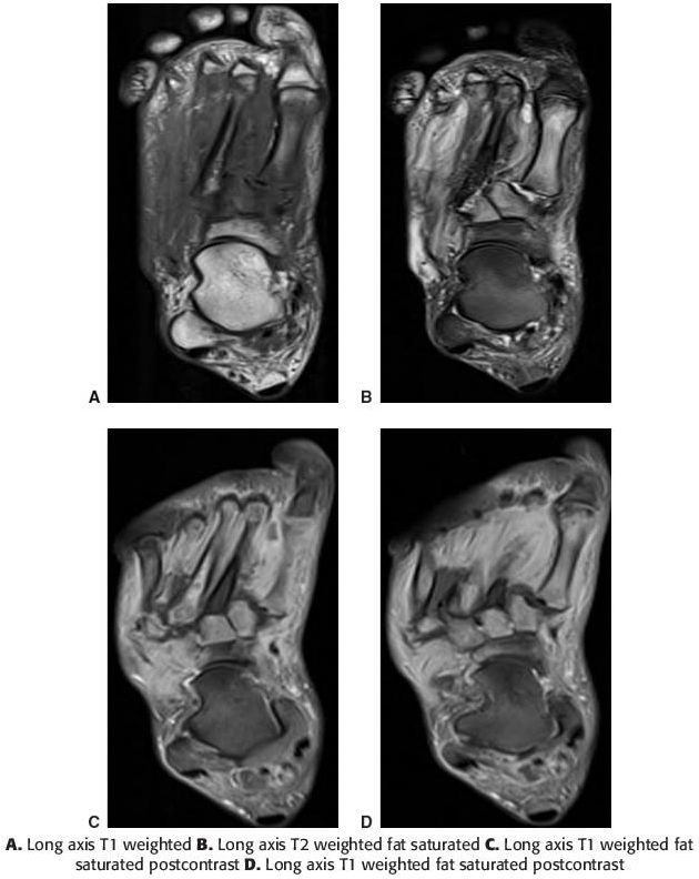 Infection Radiology Key