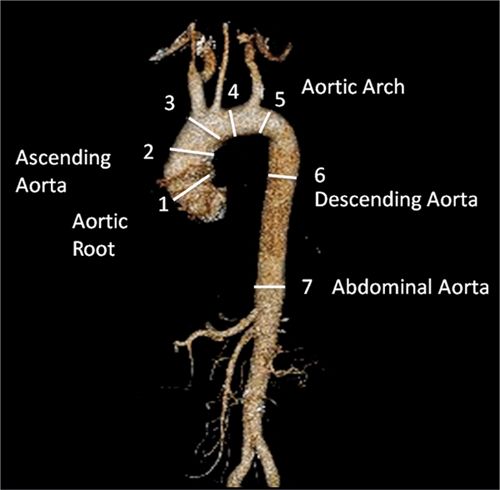 The Aorta Radiology Key
