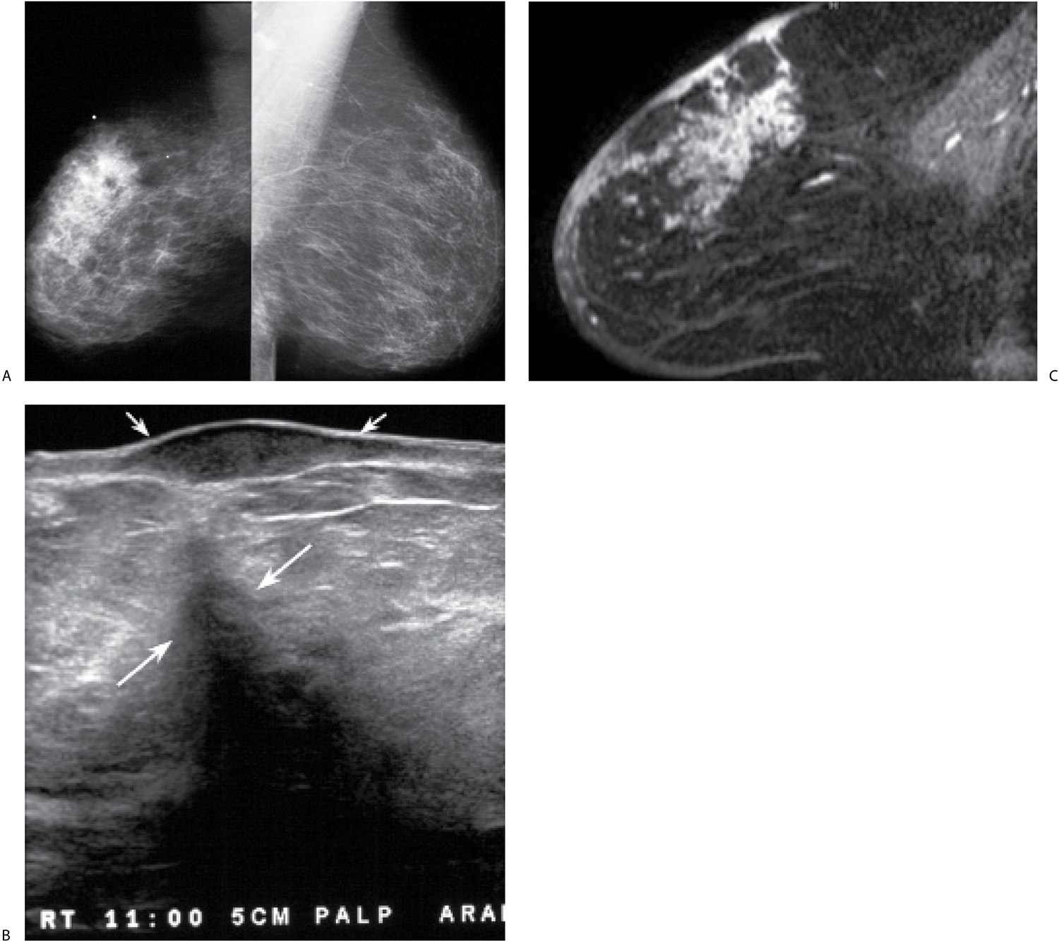 A photograph of the patient's left breast. Clinical appearance of