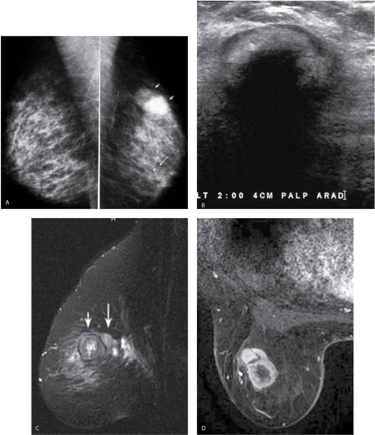 anne arundel diagnostics breast imaging