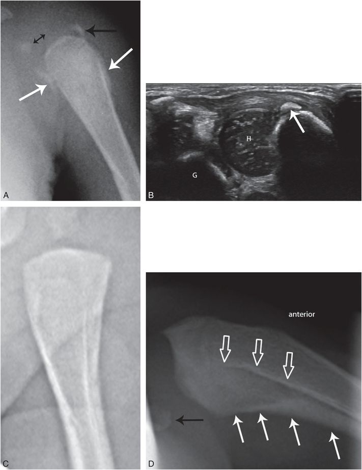 Differential diagnosis V: obstetric trauma | Radiology Key