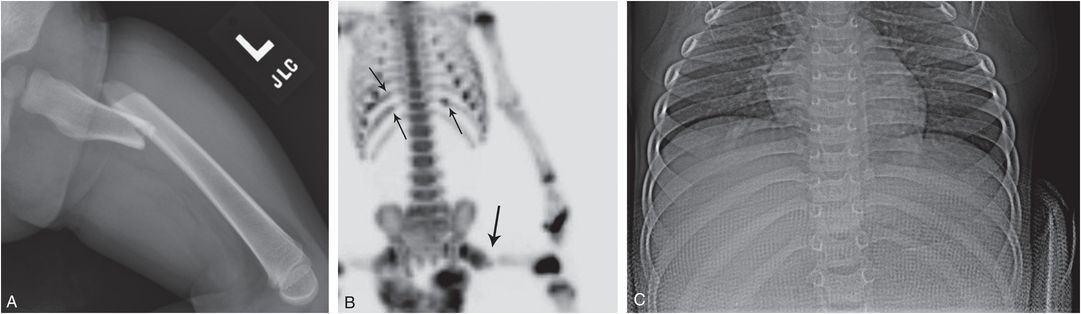 Skeletal Imaging Strategies | Radiology Key