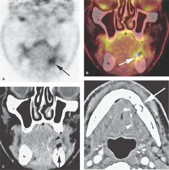 Oral Cavity Infectious And Noninfectious Inflammatory Conditions