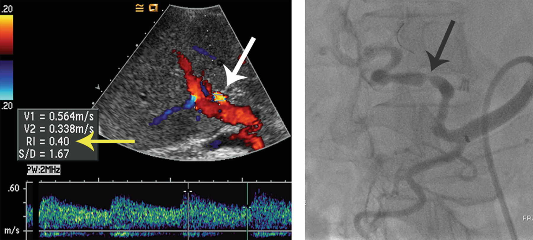 HsuWC1e-ch006-image062a