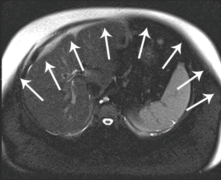 HsuWC1e-ch006-image066