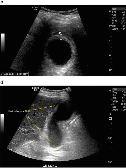 Abdomen Radiology Key 5663