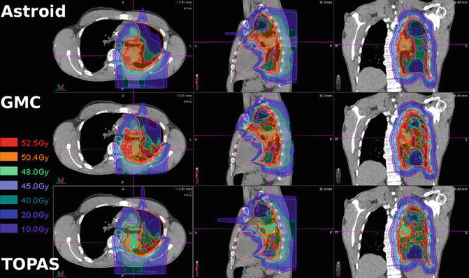 Treatment Planning for Protons: An Essay | Radiology Key