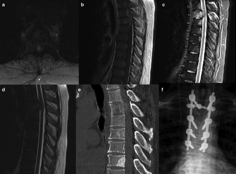 Skull Base Tumors | Radiology Key