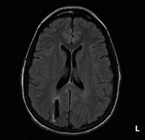 Epilepsy: Viewpoint—Medical | Radiology Key