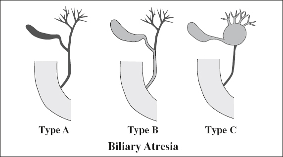 Of Liver Biliary Tract Pancreas And Spleen Radiology Key 2045