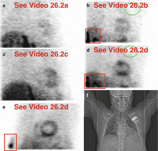 Vascular System | Radiology Key