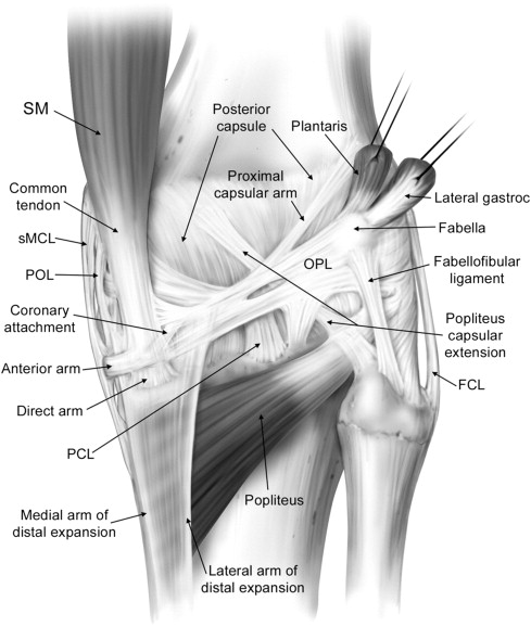 Posterolateral and Posteromedial Corner Injuries of the Knee ...