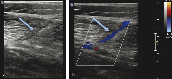 Imaging | Radiology Key