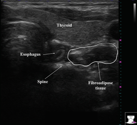 Labeled Thyroid Ultrasound