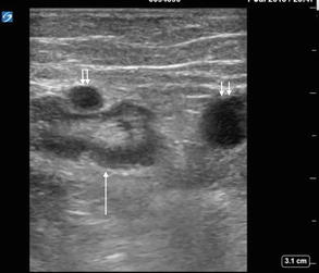 Skin Anatomy Ultrasound