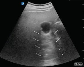 Introduction: Basic Ultrasound Principles | Radiology Key