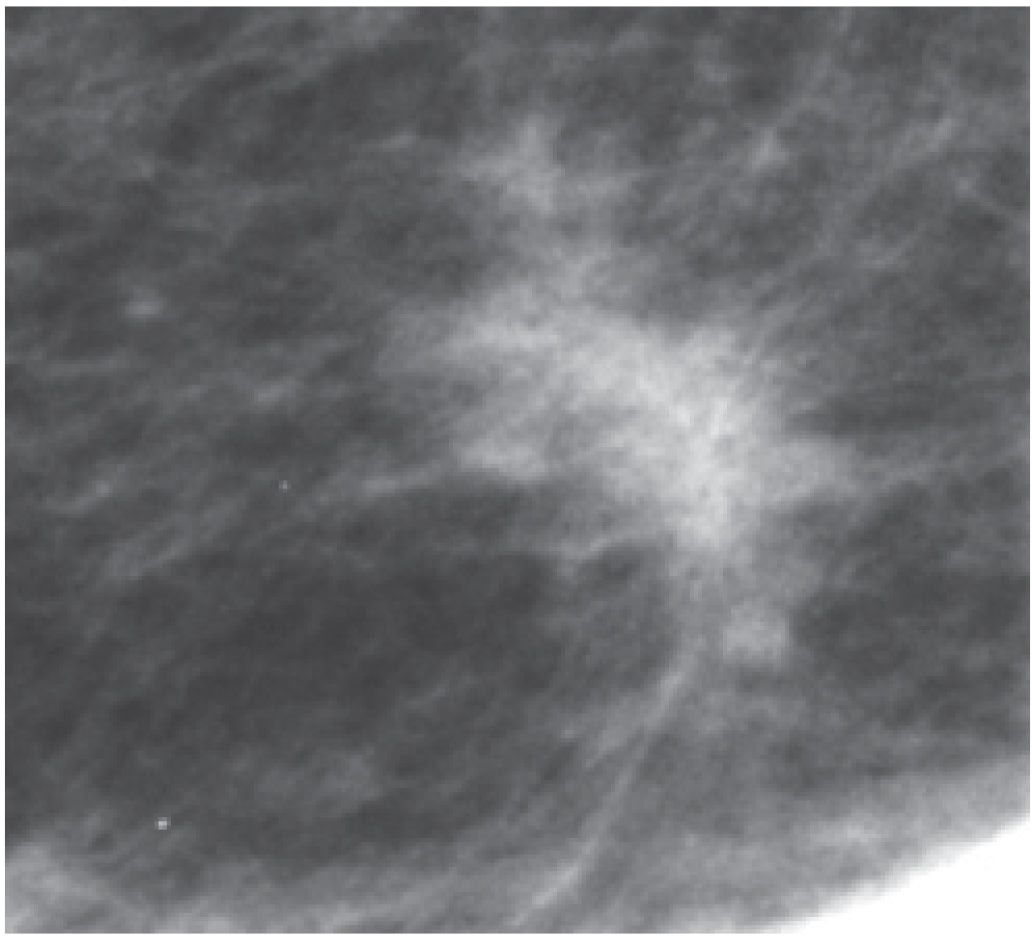 WHAT IS DIAGNOSTIC IMAGING FOR BREAST visual data 7