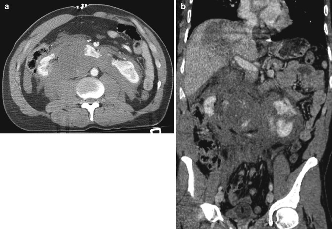 Renal Injuries Radiology Key