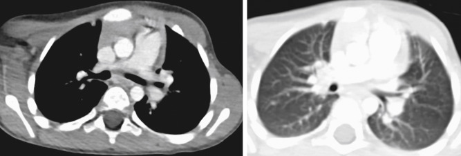 Optimizing Radiation Dose for Computed Tomography | Radiology Key