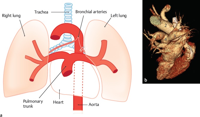 Pulmonary artery. Легочные артерии анатомия. Легочная артерия какая кровь. Легочная артерия ромбоуит. Легочная артерия створки