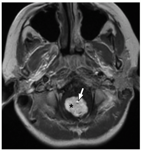 Brain | Radiology Key