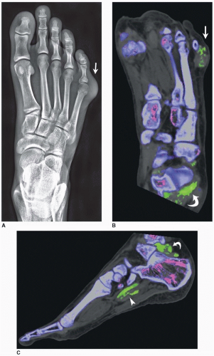 Radiologic Imaging Modalities | Radiology Key