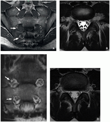 Spinal Cord Radiology Key 8998