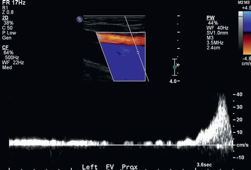 Vascular | Radiology Key