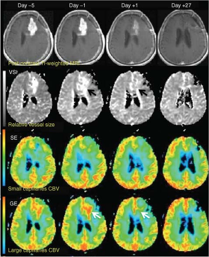 Susceptibility Contrast in Tissues: Gradient Echoes versus Spin Echoes ...