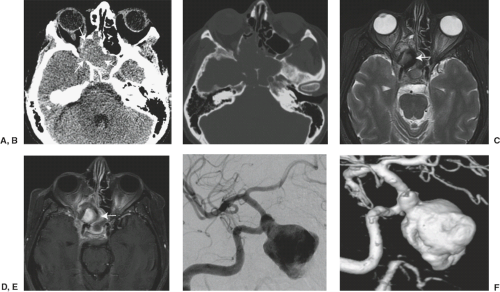 Head Trauma | Radiology Key