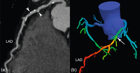 Computed tomography | Radiology Key