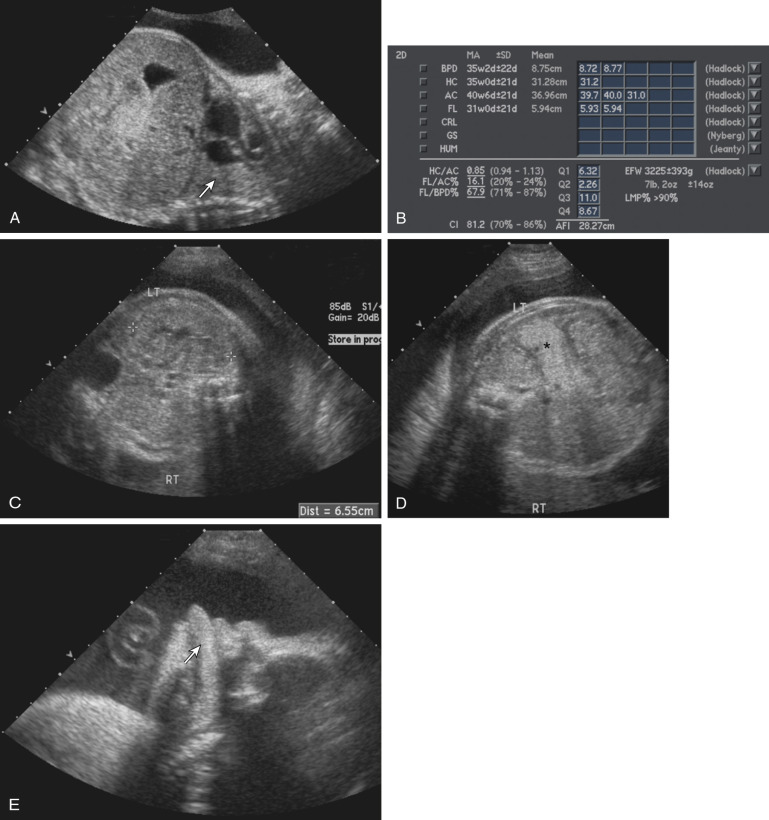 Obstetric Ultrasound Radiology Key Hot Sex Picture 8607