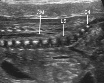 Ultrasound Evaluation of Normal Fetal Anatomy | Radiology Key