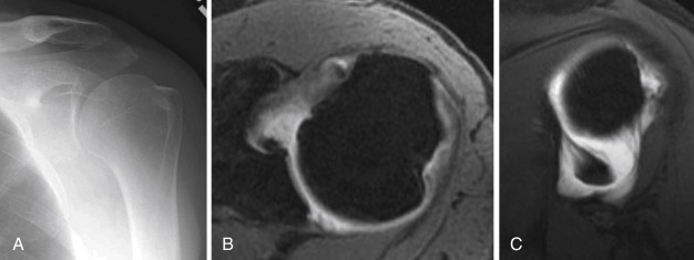 The Shoulder Radiology Key