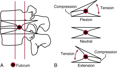 The Thoracolumbar Spine | Radiology Key