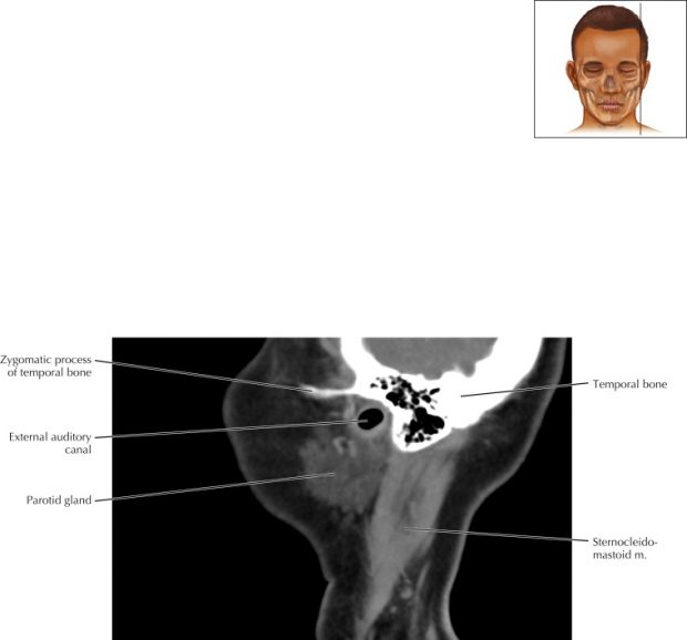 Ventricles and Cerebrospinal Fluid Cisterns | Radiology Key