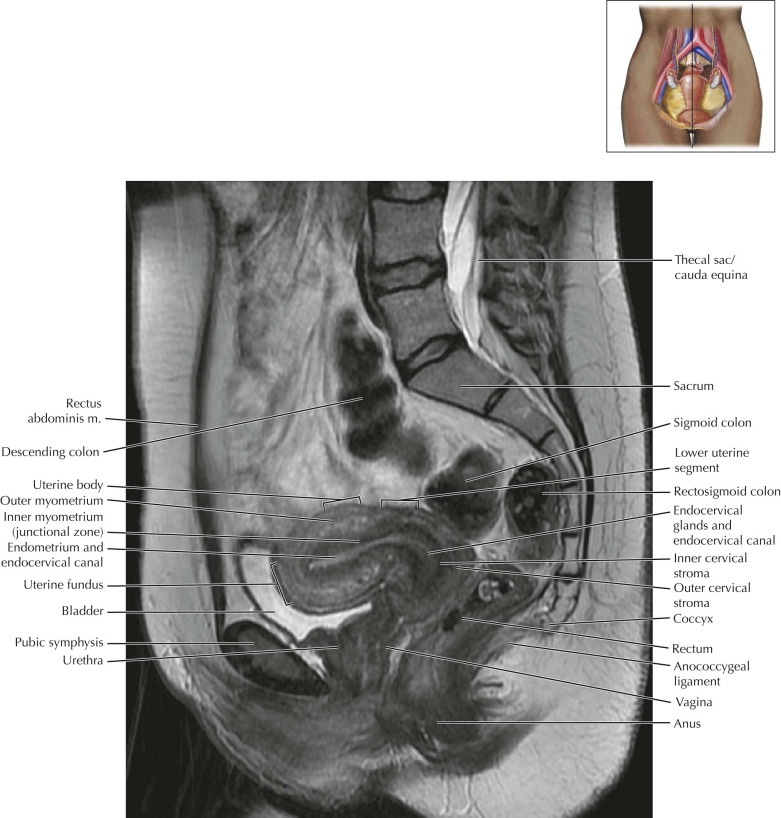 Pelvis Xray Anatomy Pelvis Xray Anatomy