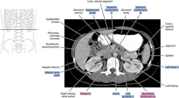 CT of the abdomen | Radiology Key