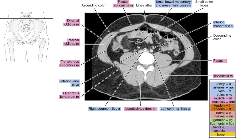 CT of the male pelvis | Radiology Key