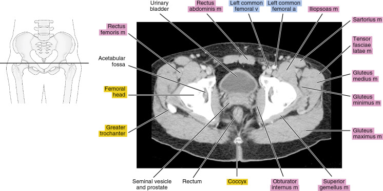 Pelvic Anatomy Ct Pin On Ct Scans Labeled Scrollable Ct Of The Images