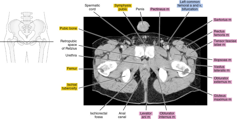 Pelvis Muscles Mri Anatomy The Pelvis Radiology Key F - vrogue.co