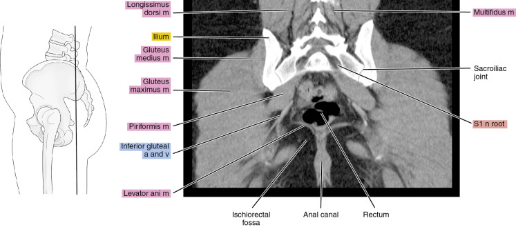 Male Pelvis CT Scan