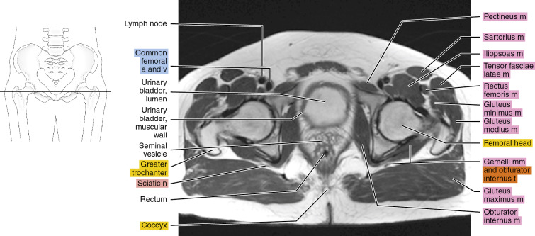 MRI of the male pelvis | Radiology Key