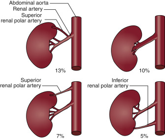 Renal Artery Disease | Radiology Key