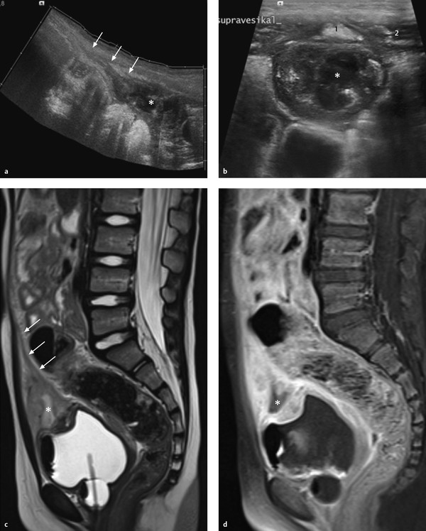 Kidney And Urinary Tract | Radiology Key