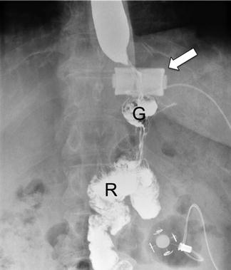 Normal Imaging Findings After Surgery | Radiology Key