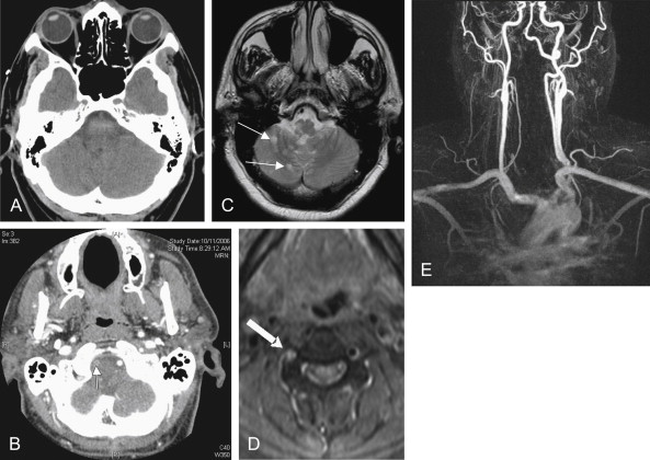 Imaging the Head and Brain | Radiology Key