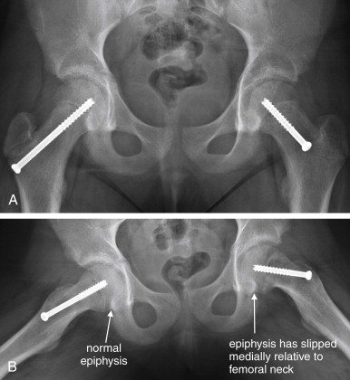Pelvis, Radiology Reference Article