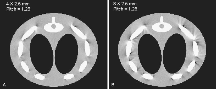 Imaging Principles In Computed Tomography Radiology Key