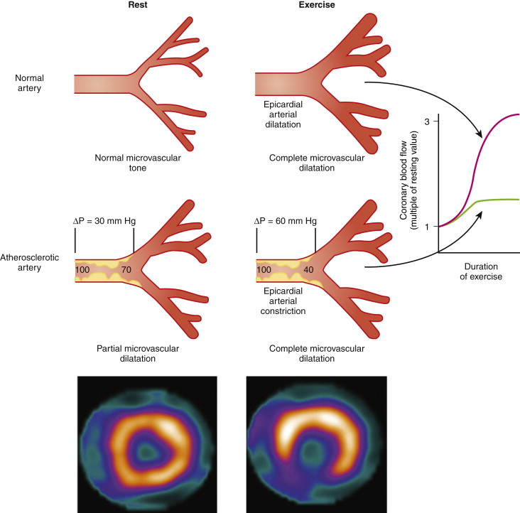 Radionuclide Imaging Cardiac Radiology Key